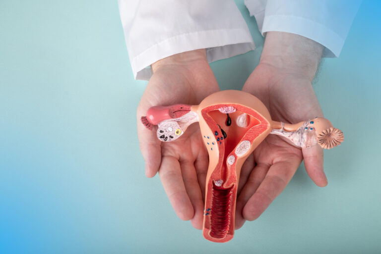 Urogynecology Care